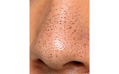 毛穴ごと肌印象を全て変える